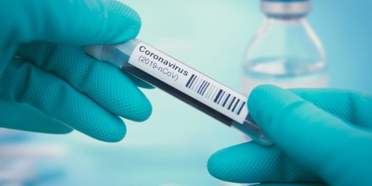 Jaraguá do Sul registra 21 novos casos de coronavírus e total chega a 440