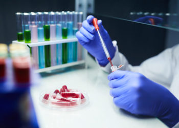 Massaranduba confirma 18 novos casos de coronavírus