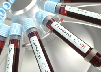 Dez novos casos de coronavírus são registrados em Massaranduba