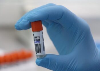 Coronavírus em SC: Lacen realizou mais de 405 mil testes RT-PCR em 2020