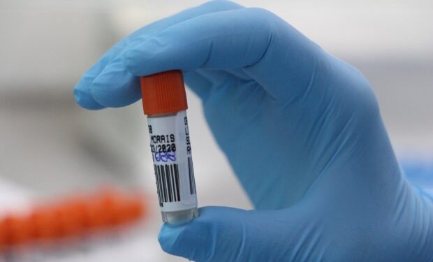 Coronavírus em SC: Lacen realizou mais de 405 mil testes RT-PCR em 2020