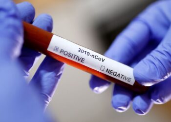 Com 18 óbitos em sete dias, Jaraguá do Sul tem a pior semana na pandemia