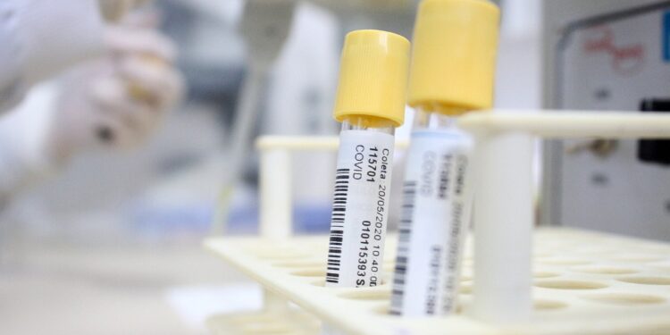 Guaramirim confirma 45 novos casos de coronavírus nesta segunda-feira (8)