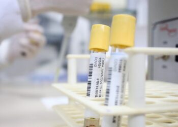 Guaramirim confirma 45 novos casos de coronavírus nesta segunda-feira (8)