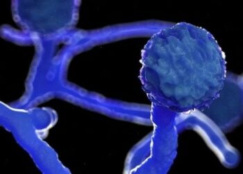 Jaraguá do Sul tem caso suspeito de fungo negro