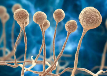 Saúde de Jaraguá do Sul segue investigação sobre caso suspeito de fungo negro