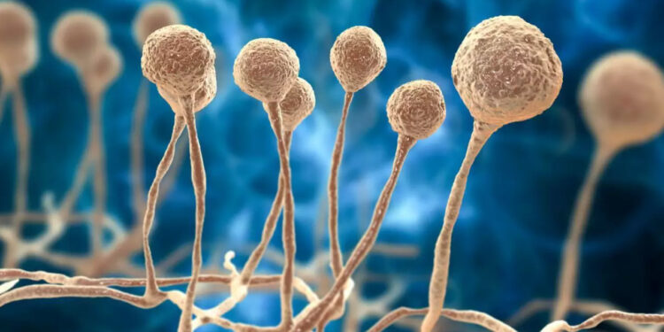 Saúde de Jaraguá do Sul segue investigação sobre caso suspeito de fungo negro