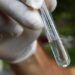 Secretaria da Saúde confirma quinta morte por dengue em Joinville