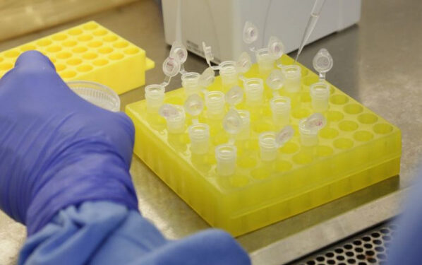 Schroeder fará ação para testes rápidos em pessoas sem sintomas nesta quarta (4) e quinta-feira (5)