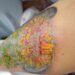 Tatuador usa tinta imprópria e mulher quase perde a perna em Joinville