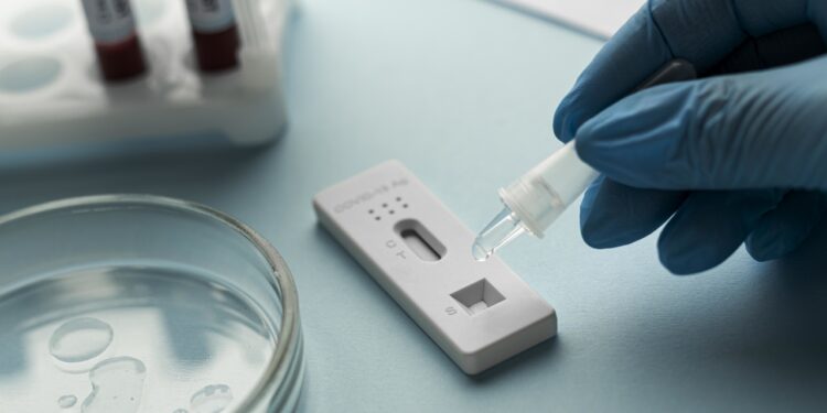 Prefeitura de Guaramirim alerta para aumento de casos de Covid-19