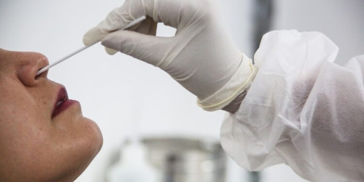 Anvisa aprova primeiro autoteste para Covid no país