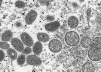 SC investiga novo caso suspeito de varíola dos macacos