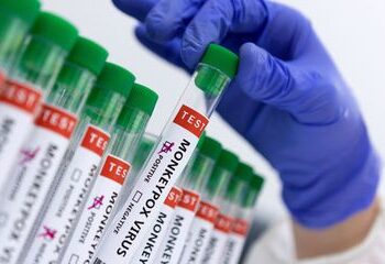 Sobe para 142 o número de casos de varíola dos macacos no Brasil