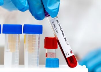 Após primeiro caso confirmado, Jaraguá do Sul divulga orientações sobre varíola dos macacos