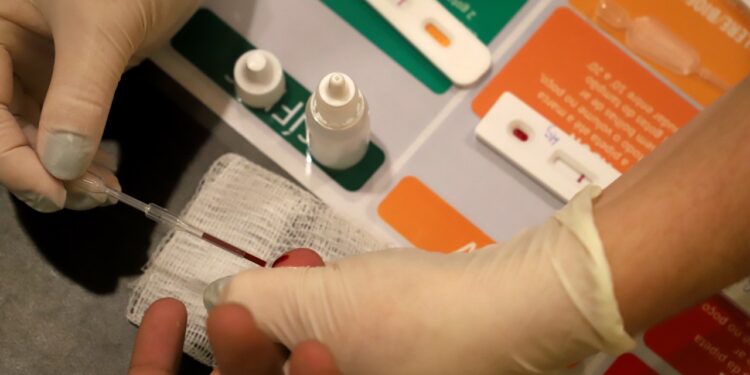 Mais de mil testes foram realizados na Campanha Jaraguá Hepatite Zero