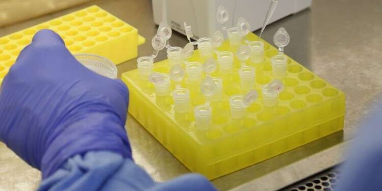 Santa Catarina tem 36 casos confirmados de varíola dos macacos