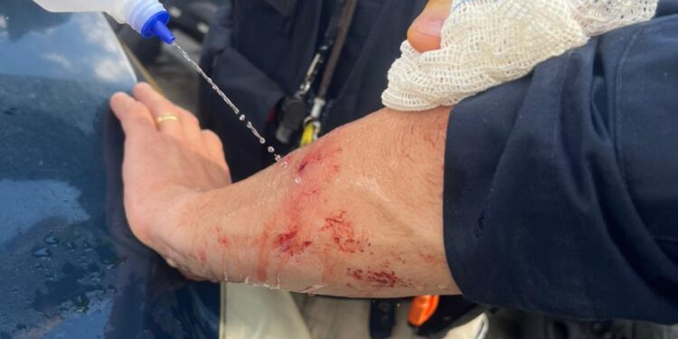 [Fotos] Homem é detido em SC por tentativa de homicídio contra agente da PRF