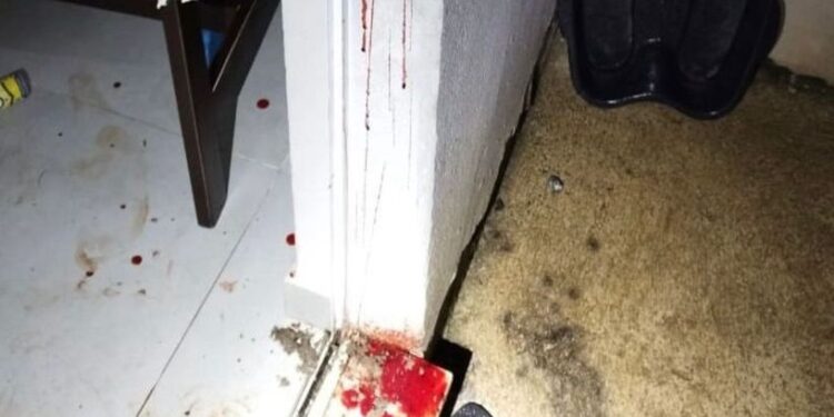 Mulher é atacada pelo ex-marido com golpes de faca, em Guaramirim