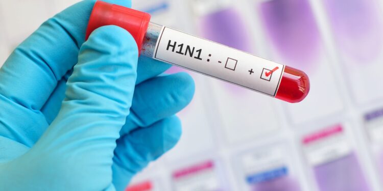 Jaraguá do Sul confirma primeiro óbito por Influenza A H1N1 de 2023