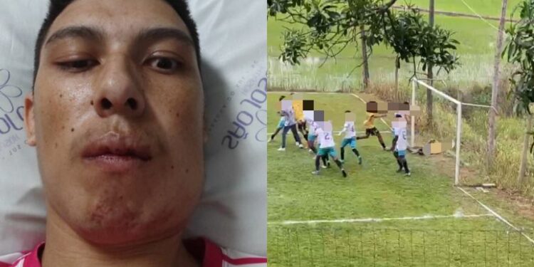 Morre jovem agredido em jogo de futebol em Guaramirim
