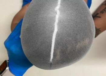 Família faz campanha para tratamento de bebê que nasceu prematuro