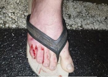 Homem é atacado por dois cachorros em Jaraguá do Sul