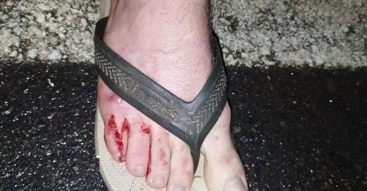 Homem é atacado por dois cachorros em Jaraguá do Sul