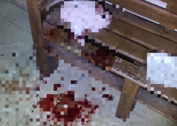 Briga em “casa de diversão adulta” acaba com mulher ferida em Massaranduba