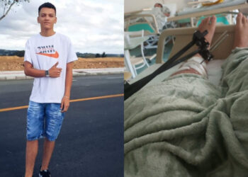 Jaraguaense que se acidentou precisa de ajuda