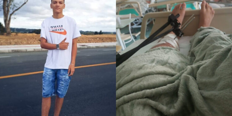 Jaraguaense que se acidentou precisa de ajuda