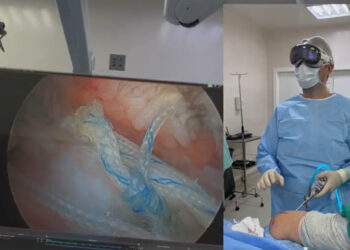 [Vídeo] Apple Vision Pro é usado em cirurgia ortopédica em Jaraguá do Sul