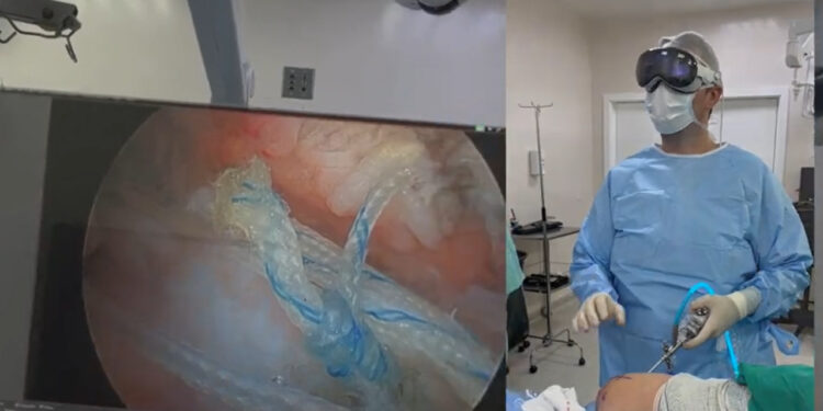 [Vídeo] Apple Vision Pro é usado em cirurgia ortopédica em Jaraguá do Sul