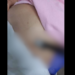 Ex-companheiro esfaqueia mulher e faca quebra dentro do corpo da vítima em Joinville