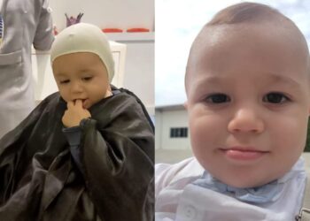 Família de Jaraguá do Sul busca ajuda para tratamento de bebê com plagiocefalia