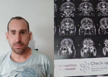 Morador de Jaraguá do Sul é diagnosticado com tumor no cérebro e precisa de ajuda para cirurgia de emergência