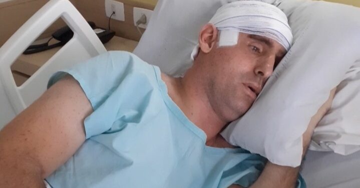 Com dinheiro de campanha, jaraguaense que estava com tumor no cérebro passa por cirurgia: “100% retirado”