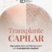 Transplante Capilar: autoestima e transformação em cada fio