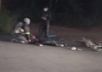 [Vídeo] Adolescente em moto elétrica fica ferida após acidente em Guaramirim