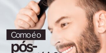 Como é o pós-transplante capilar?