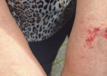 Homem é detido após agredir a própria mãe em Jaraguá do Sul