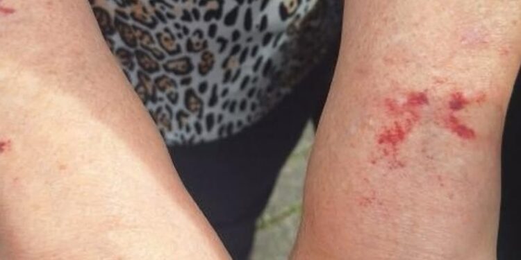 Homem é detido após agredir a própria mãe em Jaraguá do Sul