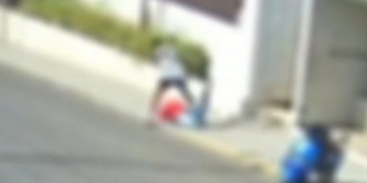 Jovem tem mão amputada após ataque de ex-namorado em SC