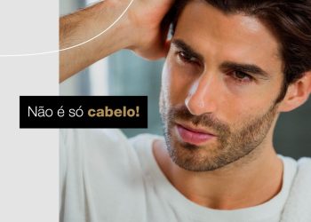 A perda capilar vai muito além da estética