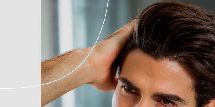 A perda capilar vai muito além da estética