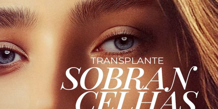 Transplante de Sobrancelha