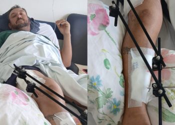 Morador de SC pede ajuda após sofrer acidente de trabalho