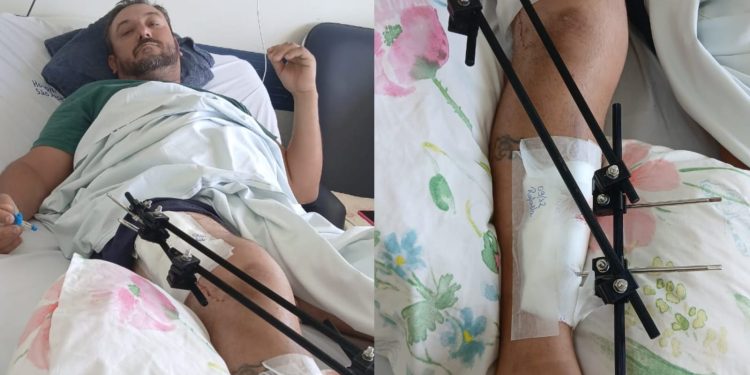 Morador de SC pede ajuda após sofrer acidente de trabalho