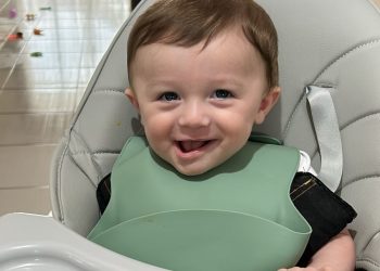 Bebê de Jaraguá do Sul precisa de capacete especial para tratamento de braquicefalia