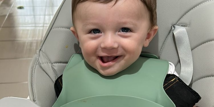 Bebê de Jaraguá do Sul precisa de capacete especial para tratamento de braquicefalia